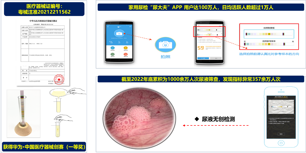 尿液无创诊断研究